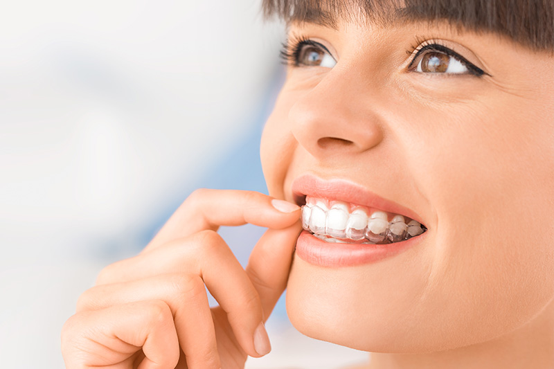 Invisalign in Chevy Chase