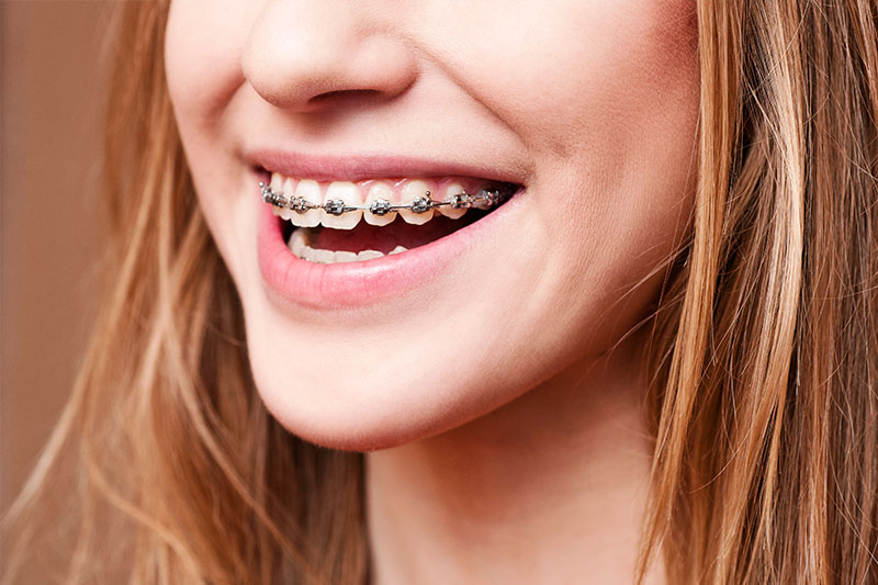 Orthodontics in Chevy Chase